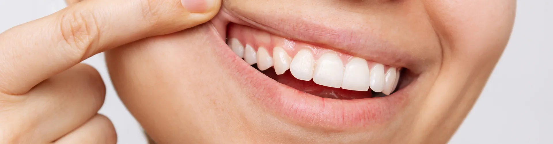 woman lifting upper lip to reveal gums