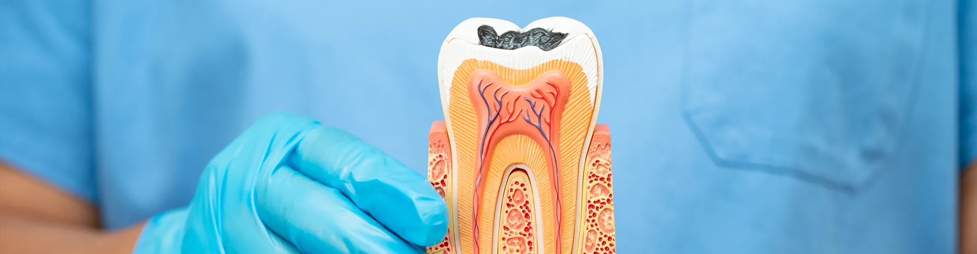 gloved hands holding tooth model showing the anatomy