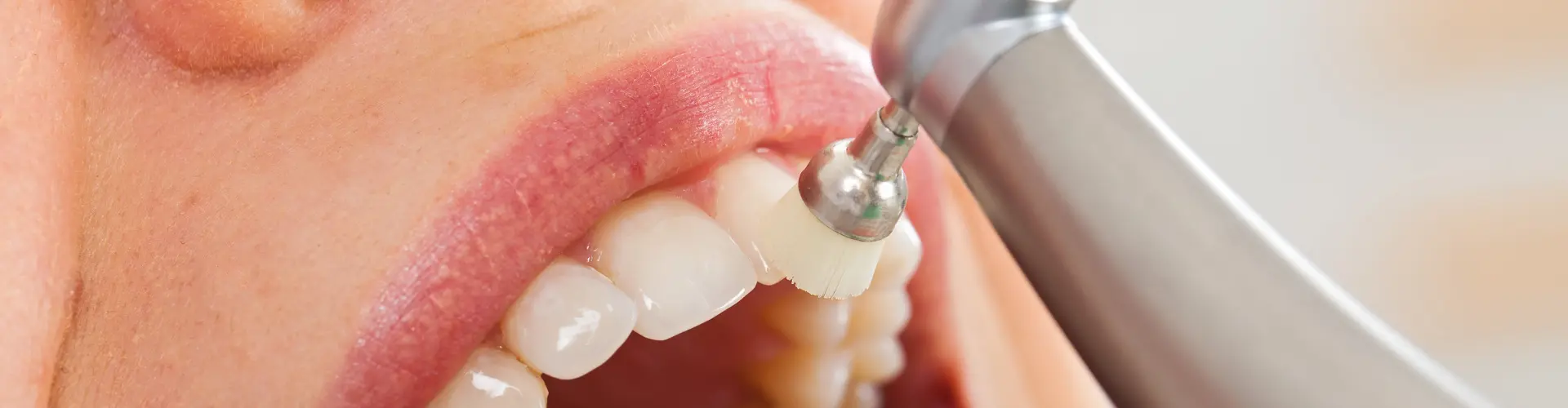 teeth cleaning tool being used on woman's teeth