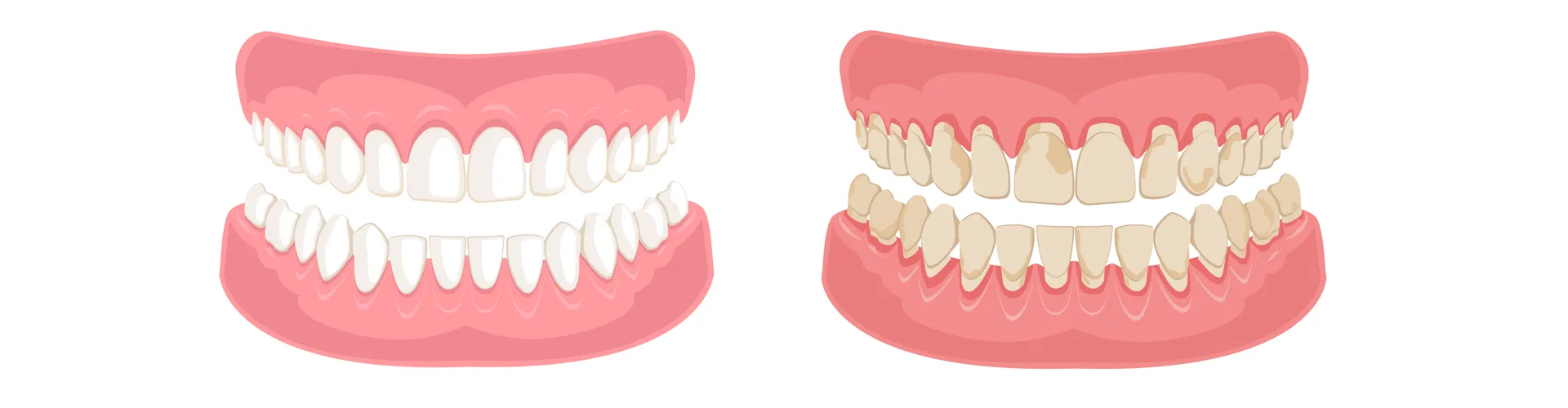 Teeth illustration