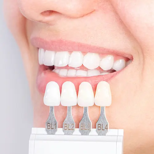 teeth shade-matching tool beside woman's smile