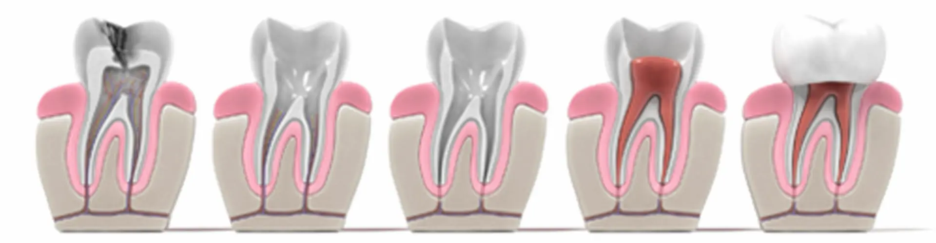 Teeth illustration