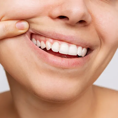 woman lifting upper lip to reveal gums