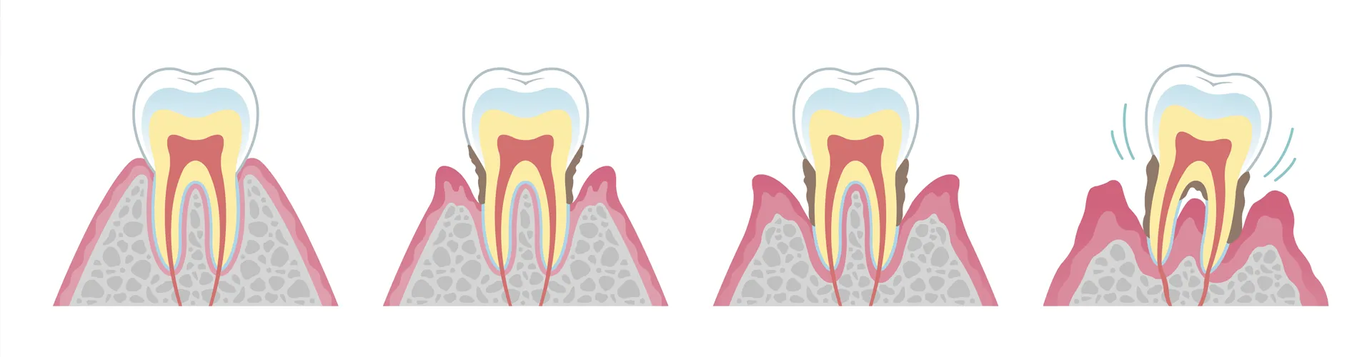 Teeth illustration